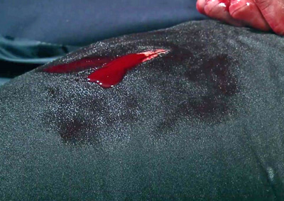 leg-wound-let-it-bleed leg-wound-let-it-bleed