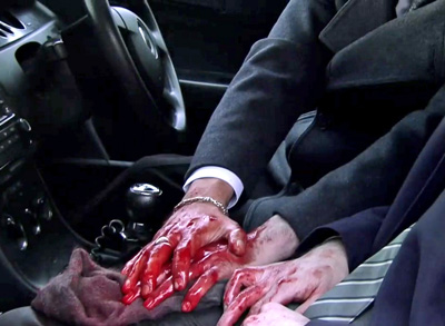 peter-holds-cloth-on-leg peter-holds-cloth-on-leg let it bleed